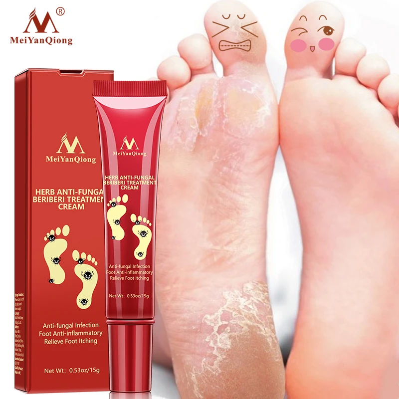 leg crack removal cream