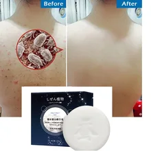 Морская соль мыло козье молоко мыло ручной работы для удаления прыщей поры, акне Лечение Уход за кожей лица мыть мыльной основы, уход за кожей, TSLM2