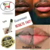 Lips Pink Fresh Fast Lightening Bleaching Cream Balm Treatment Remove Dark Lips 1