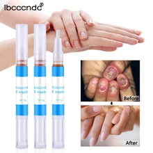 Средство для лечения грибка ногтей, средство для ухода за ногтями, антигрибковая ручка для ухода за ногтями TSLM1