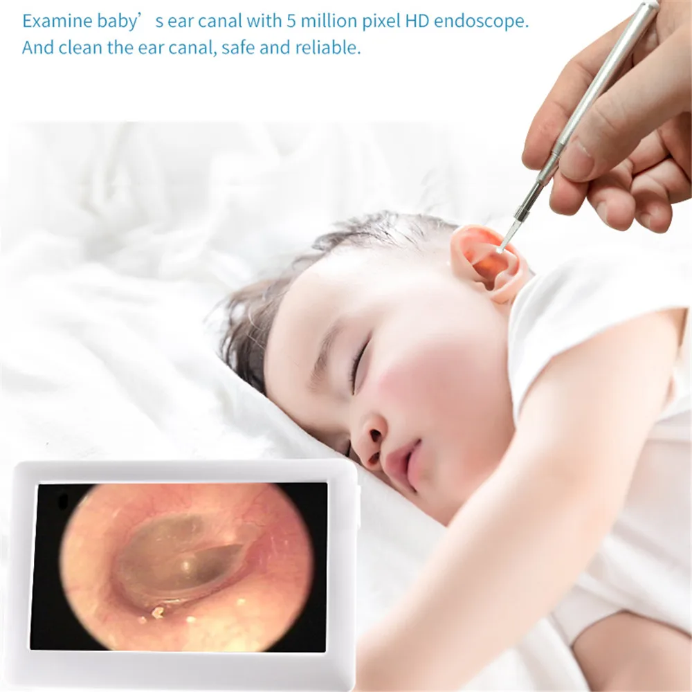 3.9MM Video Otoscope Camera 1080p 4.3 Inch Screen Ear Inspect Earwax Camera HD Display Digital Medical Endoscope Cleaning Tool