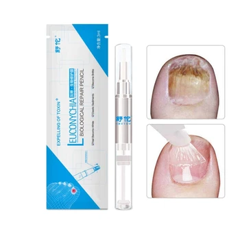 

Herbal Nail Treatment Pen Nail Repair Fingernails Toenails Rich Nutrition