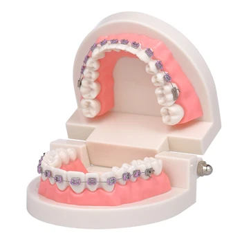 

Dental Orthodontic Mallocclusion Model with Brackets Archwire Buccal Tube Teeth Model for Patient Communication Adult Teaching