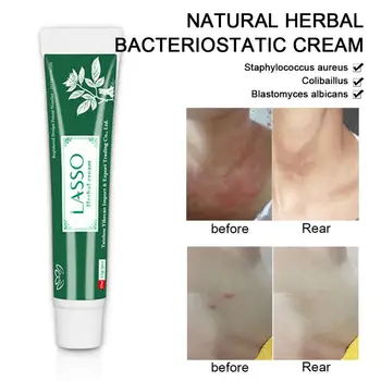 

Natural Chinese Medicine Anti Cream Treatment Psoriasis Eczema Ointment Cream No Box TSLM1