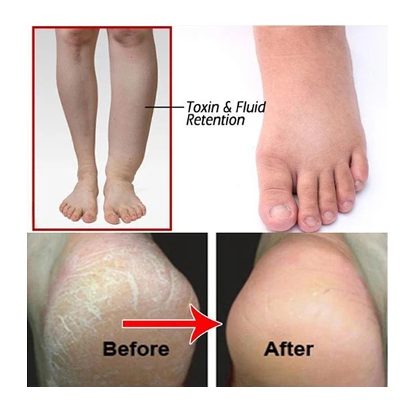 High-Quality-Ginger-Effervescent-Tablets-Foot-Bath-Anti-swelling-SPA-Massage-Pedicure-Foot-Care