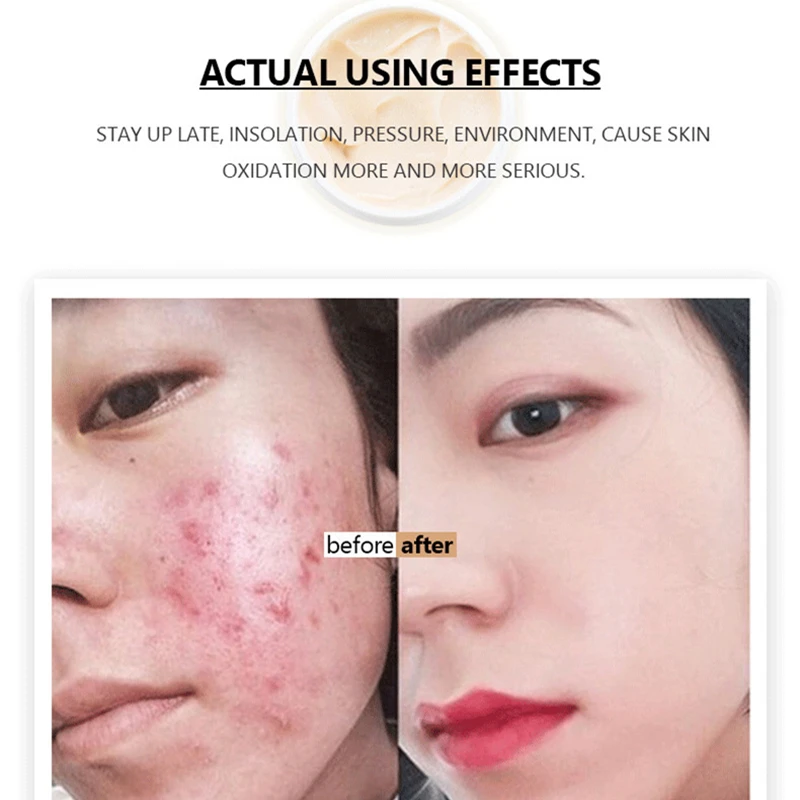 Dr Sugarm Herbal Repair Acne Whitening Face Cream Moisturizing Anti Wrinkle Anti Aging Face Fine Lines 5