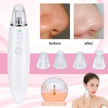

Electric Blackhead Remover Acne Vacuum Cleaner Black Dot Pimple Pore Skin Care Tools Nose Face Deep Cleansing Suction Machine