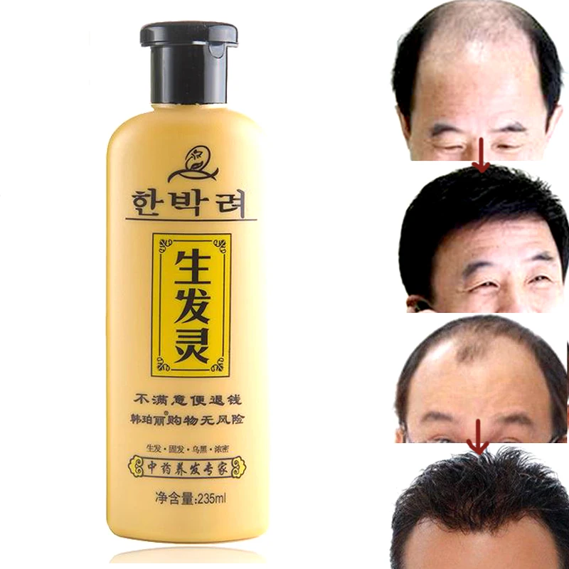 Producto para el cuidado del cabello, productos para la pérdida del cabello, efectos rápidos, medicina de restauración de alopecia posparto, champú de crecimiento denso, crema para la caspa