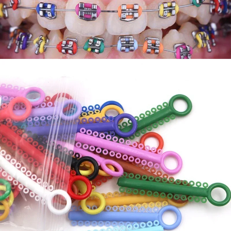 

NSKLED 40 Pcs 1 Pack Dental Elastomeric Ligature Ties Orthodontics Elastic Rubber Bands Braces