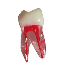 2pcs Dental Tooth Model Root Canal RCT Practice Pulp Cavity Clear Resin Teaching Teeth Model For Dentistry Therapy Tools
