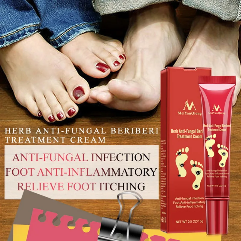 Травяное эффективное лечение ног против грибковой инфекции onychomicosis Paronychia Toe Fungus Treatment крем для ухода за ногами