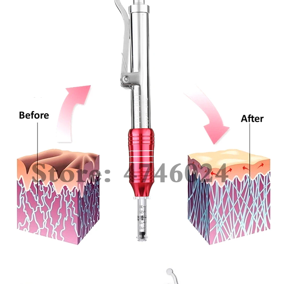 Горячая Неинвазивная ручка для Инъекций Ручка гиалуроновой кислоты без игольчатый инжектор гиалурон ручка пистолет для наполнения губ против морщин Подтяжка лица