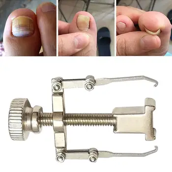 

Ingrown Toenail Toe Fixer Recover Correction Device Pedicure Foot Nail Care Tool Protector Tool Pedicure Foot Nail Care