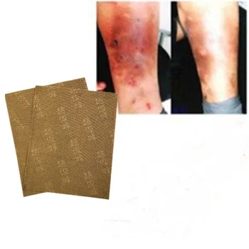 

4pcs/set Spider Veins Varicose Treatment Plaster Varicose Veins Cure Patch Vasculitis Natural Solution Herbal Patches Skin Care