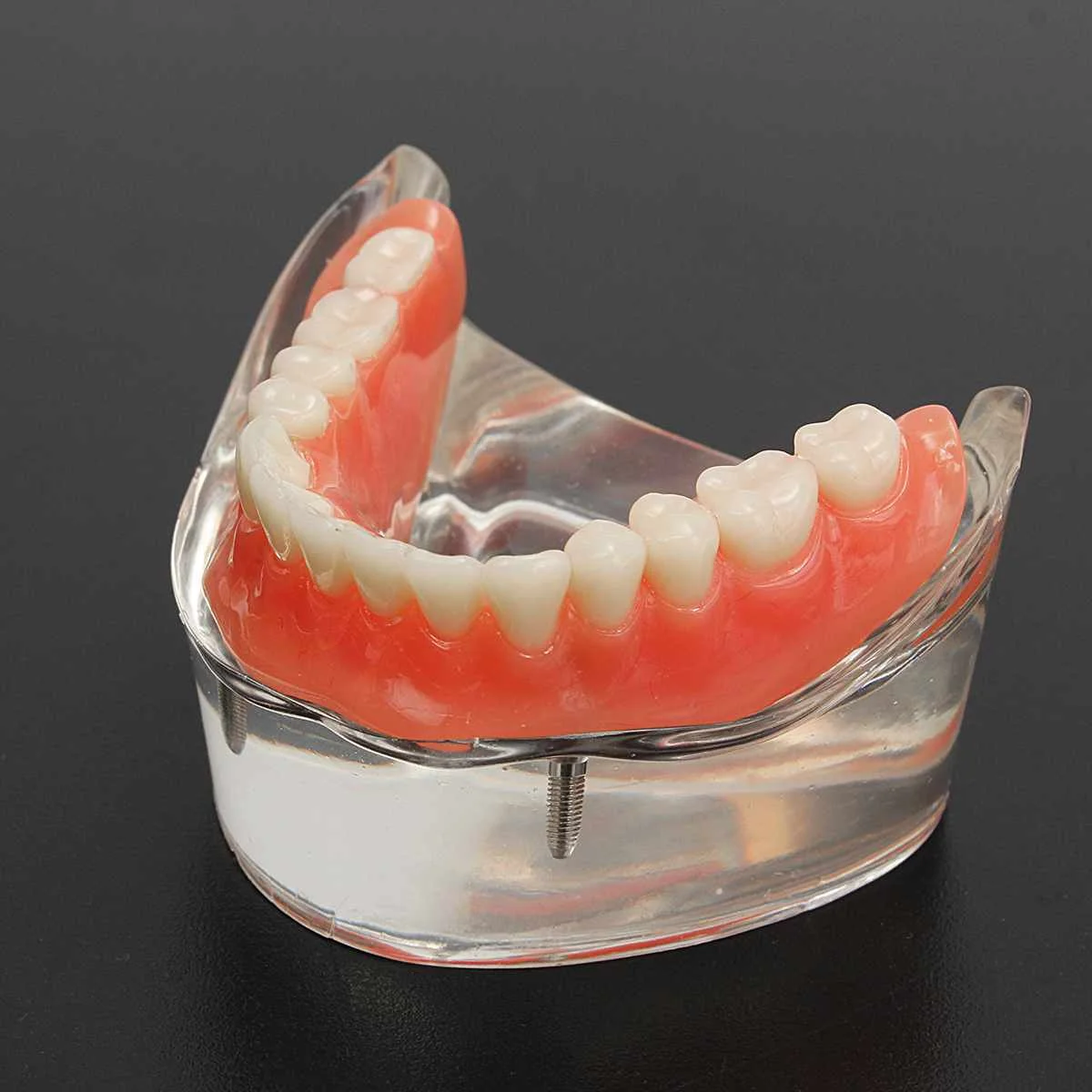 

Acrylic Restoration Overdenture Teeth Model Dental Inferior Precision Implants Demonstration Dental Teaching Repair Model
