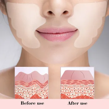 

Facial Lip Wrinkle Remover Pad Reusable Silicone Nasolabial Folds Anti-aging Mask Prevent Face Wrinkle