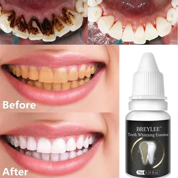 

10ml Hygiene Natural Teeth Cleaning Essence Liquid No Preservatives Serum Remove Oral