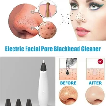 Средство для удаления черных точек лица, глубокие электрические поры на лице, Удаление прыщей, вакуумное Очищение лица, Алмазное оборудование для красоты, инструмент для спа