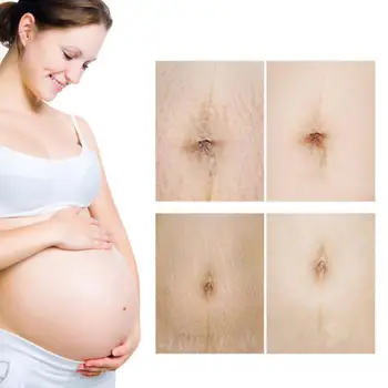 

20g stretch marks removal maternity firming cream anti-wrinkle cream pregnancy repair body cream women's scar removal Scar