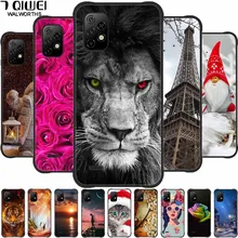 For Umidigi Bison X10 Case X 10 Silicone Soft Protective Phone Cases for Umidigi Bison X10 Pro Back Cover TPU Full Protection