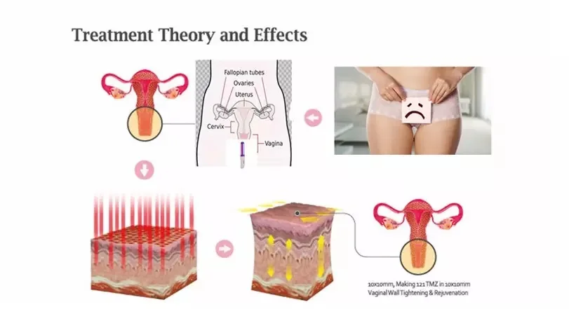 HTB1P.WAcBLN8KJjSZFp762ZaVXan.png_