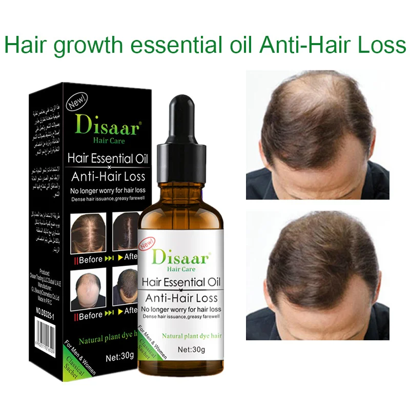 New Hair Growth Essence Oil Fast Powerful Hair Growth Oil Products Essential Oil Treatment Preventing Hair Loss Hair Care 30ml New Hair Growth Essence Oil Fast Powerful Hair Growth Oil Products Essential Oil Treatment Preventing Hair Loss Hair Care 30ml