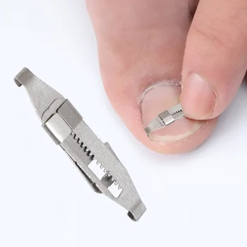 

Stainless Steel Toenails Correction Buckles Toenails Clip Straightening Clip Nail Patch Tool Armor Corrector Accessory