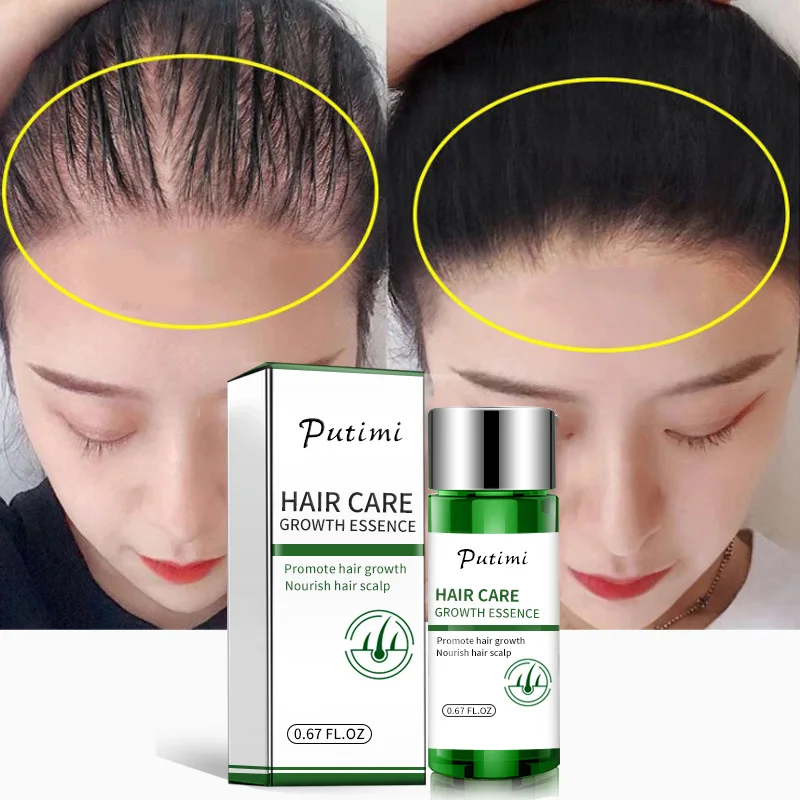 PUTIMI эссенция для роста волос продукты против выпадения волос экстракт имбиря лечение волос Предотвращение выпадения волос Растущая Сыворотка для волос 20 мл