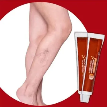 

Varicose Vein Ointment Angiitis Removal Medical Plaster Vasculitis Phlebitis 20g Varicose Vein Spider Cream