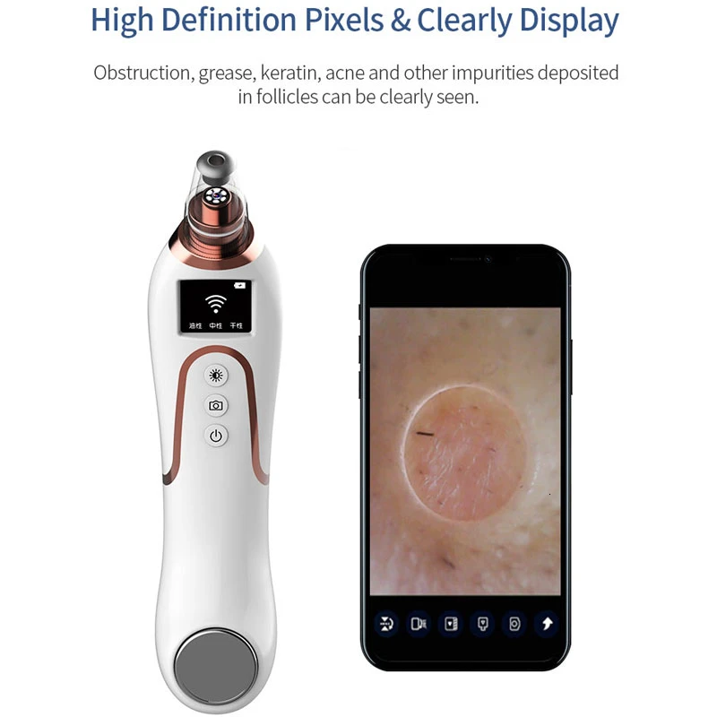 Новейший электрический аппарат для удаления черных точек на лице