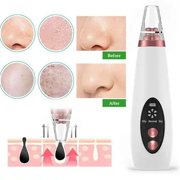 

Facial Cleaning Black Head Cleaner Acne Cleaner ABS Effective Fashion Fast Clear Beauty Health Clean Remove Skin Care