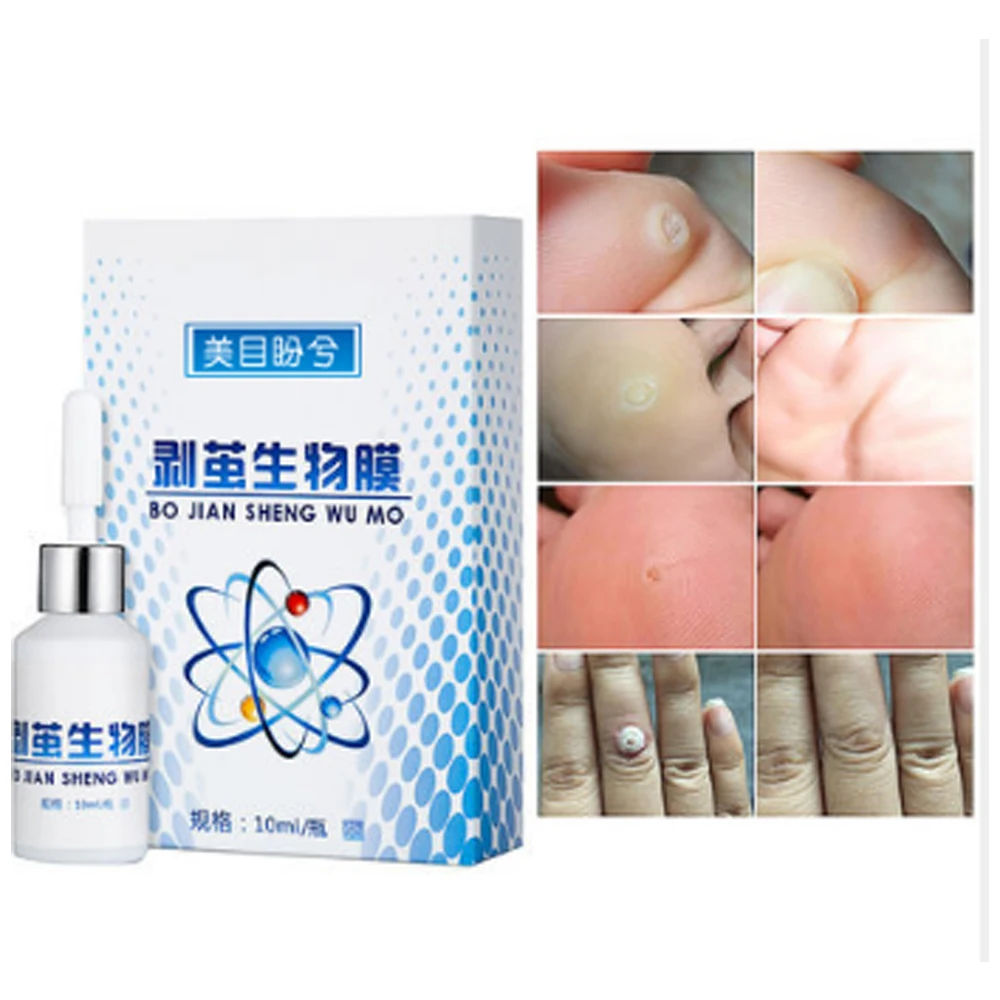 

10ml Skin Tag Remover 12 hours Tu kill Medical Tu kill Remover Skin Tag Mole & Genital Wart Remover Dropshipping D118