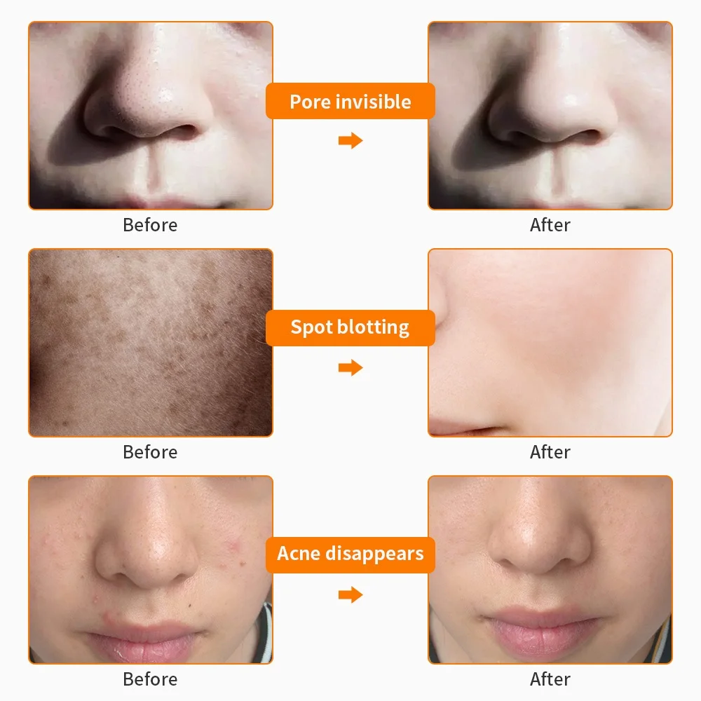  Rechargeable 8 Colors LED Light Photon Facial Neck Mask Wrinkle Acne Removal Skin Rejuvenation LED  - 32968069811