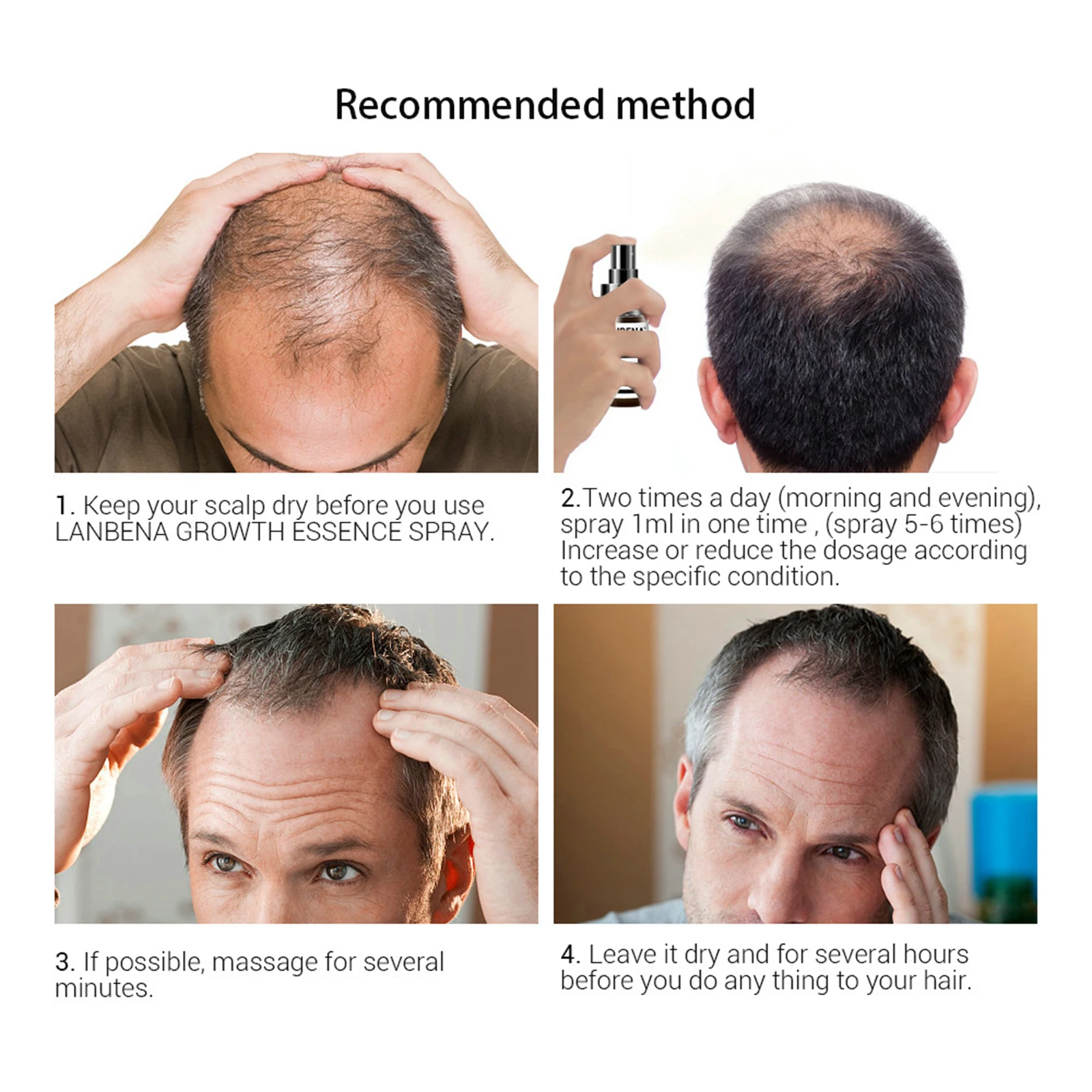 Raízes do Cabelo Crescimento do Cabelo Spray da Essência do Crescimento do Cabelo para Impedir a Calvície Forte Nutrir Rebrota Spray da Essência do para Impedir a Calvície h 5 crescimento do cabelo para impedir a calvície