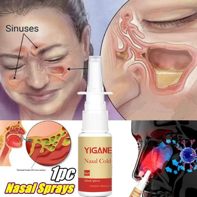 YIGANERJING Traditional Medical Herb Spray Nasal Sprays Chronic Rhinitis Spray Chinese Rhinitis Treatment Nose Care Health Care YIGANERJING Traditional Medical Herb Spray Nasal Sprays Chronic Rhinitis Spray Chinese Rhinitis Treatment Nose Care Health Care