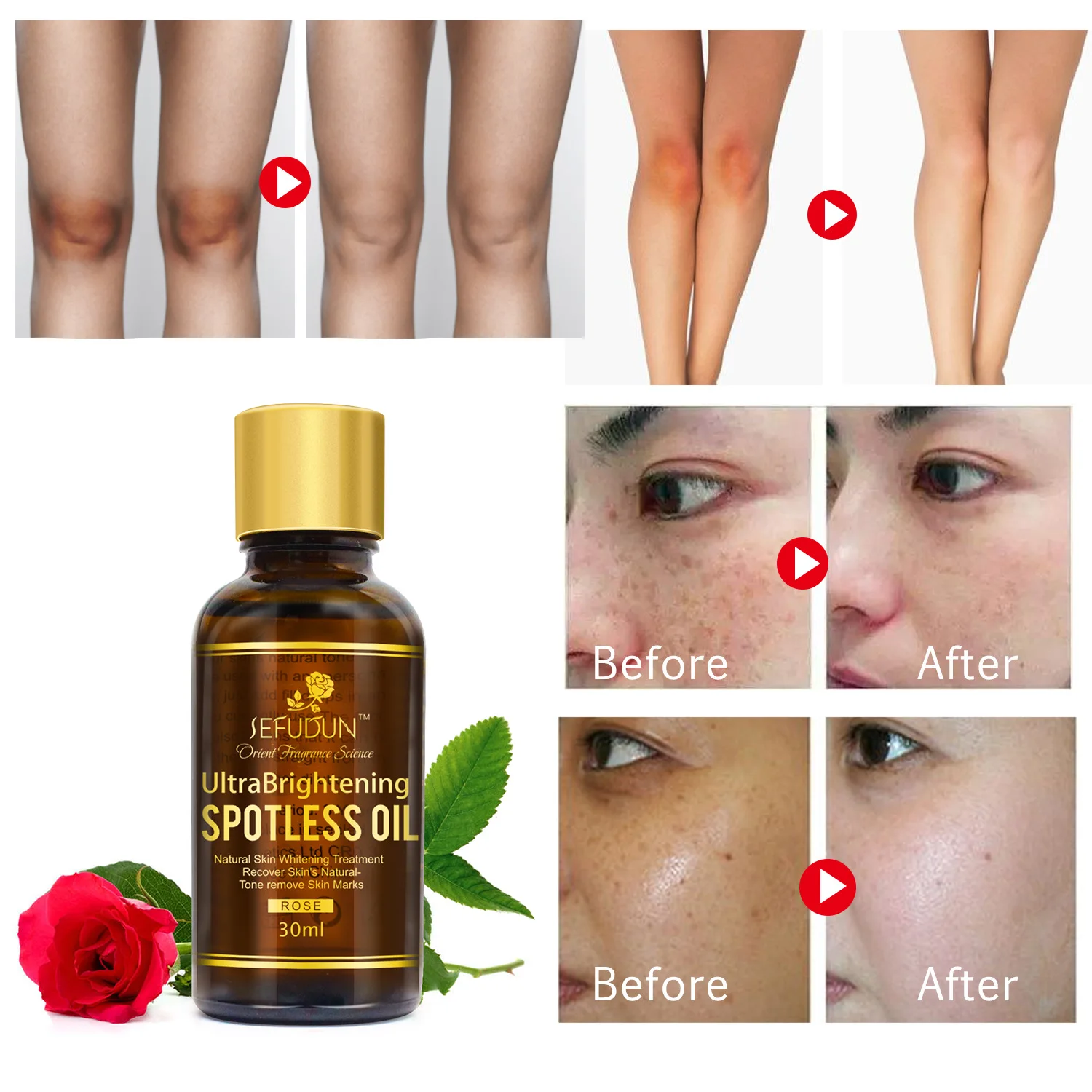 Natural Rose whitening Essential Oil Anti-wrinkle Extract Acne Removal Scars Marks Treatment Essential Oil for Any Skin Care