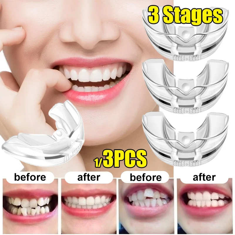 3pcs/set Tooth Orthodontic Trainer Dental Tooth Appliance Alignment
