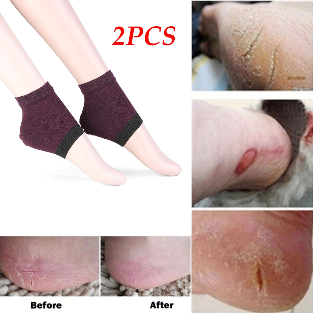 1 пара гелевых носков унисекс для увлажнения спа носки защита ног инструменты