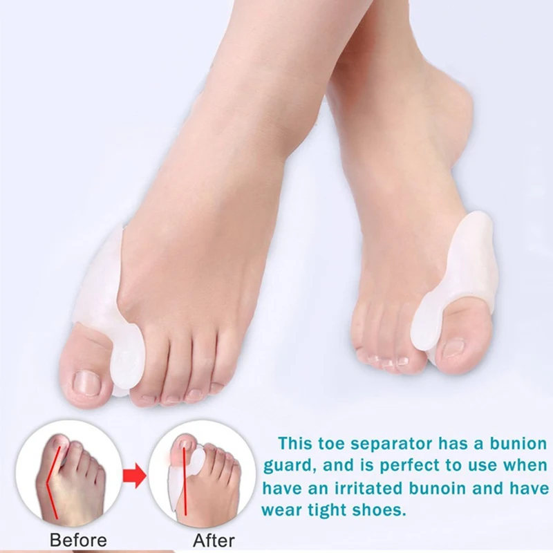 7Pcs/Set Bunion Corrector Gel Pad Stretch Nylon Hallux Valgus Protector Guard Toe Separator Orthopedic Supplies Foot Care Tool 3