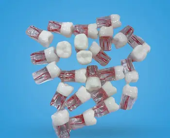 

Dental material root canal with root canal resin with granules for treatment of open pulp cavity pulp examination