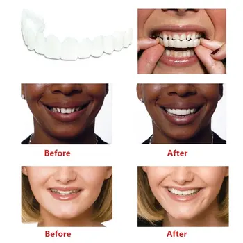 

High quality and comfortable denture care dentures, upper row of white dentures artificial dentures 5pcs