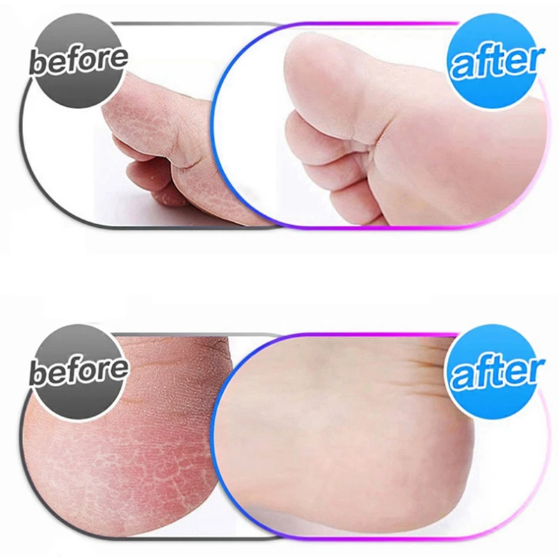 10Pcs Electric Foot Grinder Replacement Head Pedicure Machine 10Pcs Electric Foot Grinder Replacement Head Pedicure Machine