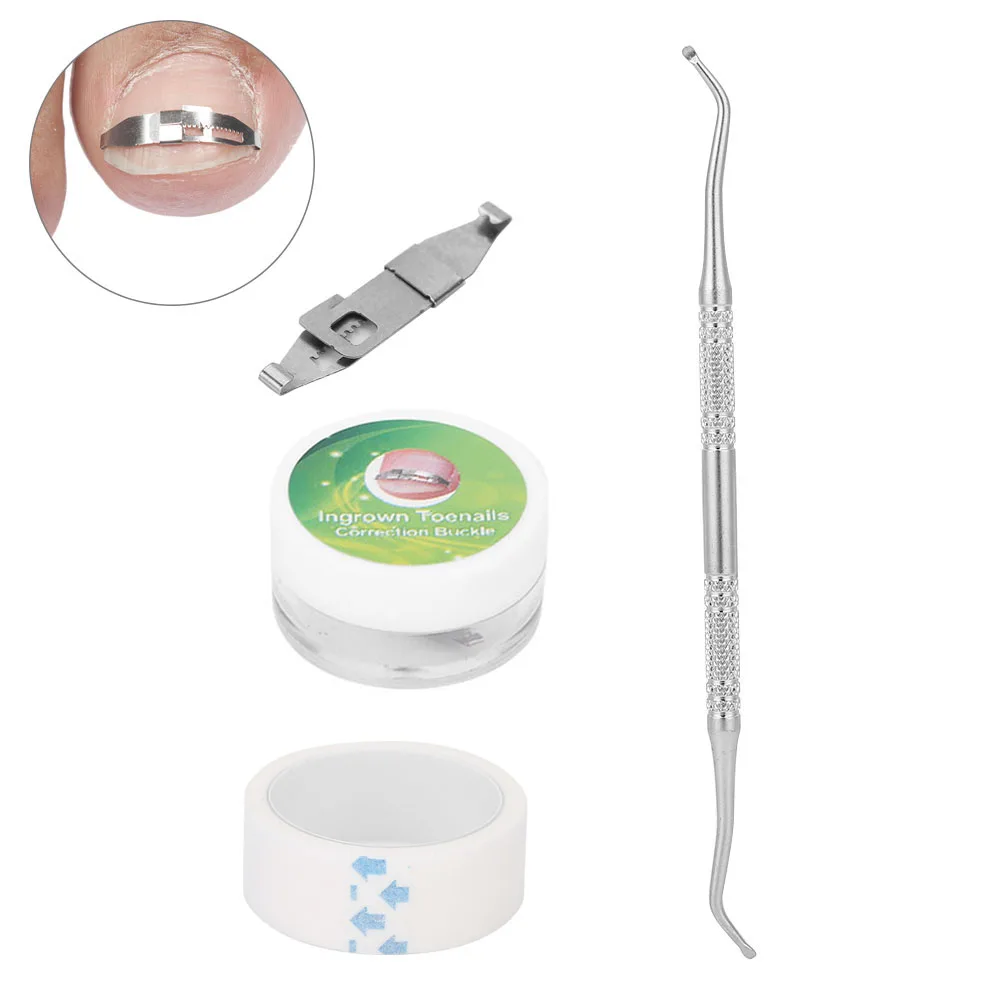 3pcs Ingrown Toenail Corrector Paronychia Treatment Nail Correction Buckle Adhesive Tape Set Ingrown Toenail Correctors 3pcs Ingrown Toenail Corrector Paronychia Treatment Nail Correction Buckle Adhesive Tape Set Ingrown Toenail Correctors