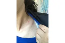 9 engranajes bolígrafo de Plasma láser Etiqueta de piel de Topo removedor de pecas verruga tatuaje mancha removedor multifunción LCD herramienta de belleza