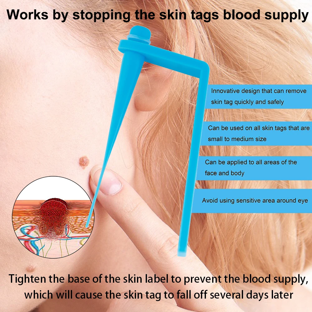 Skin Tags Remover Remove Warts Body Skin Care Tools Spot Wart Treatment Face Skin Tag Removal Tool Acne Remover|Facial Care Tool| - Aliexpress