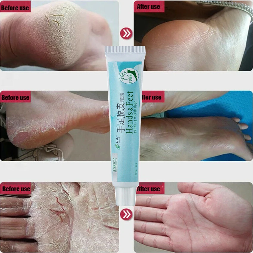 

Anti-Crack Repair Cream Heel Hand Foot Moisturizing Feet Skin Care Dry Cracked