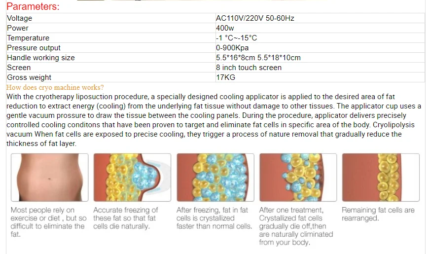 Cryolipolyse-machine