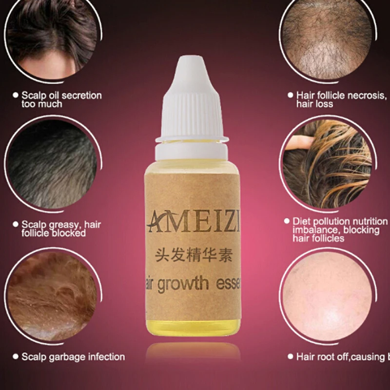 

Loss Liquid Dense Hair Fast Sunburst Hair Growth Grow Alopecia 20ml/bottle Hair Growth Essence Anti Hair