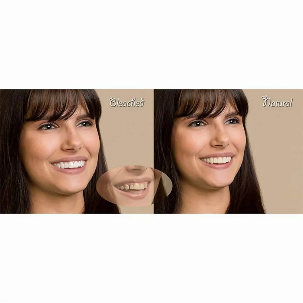 Hd5a42e61205f48329c9ce99524a64181i Beauty-Health Instant Smile Veneers Cosmetic Teeth