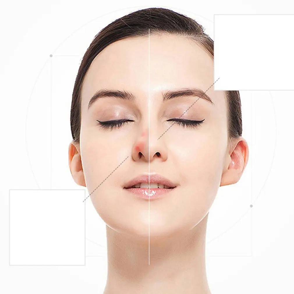  Portable Light Facial Beauty Instrument Home Lcd 9 File Remove Mole Pen Micro Freckle Pen Sweep Spo